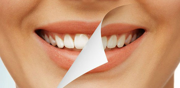Odontología Estética