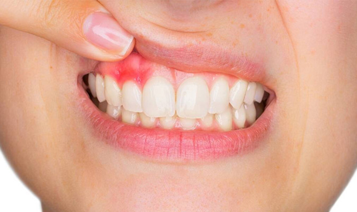 periodoncia3349 Periodoncia